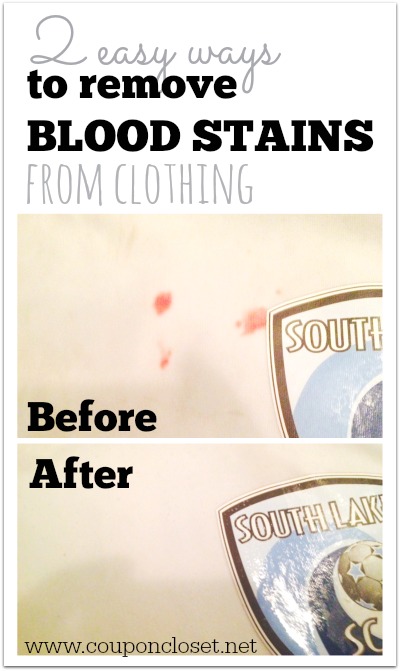 How To Remove Blood Stains From Clothing One Crazy Mom How To Remove Blood Stains From Clothing One Crazy Mom